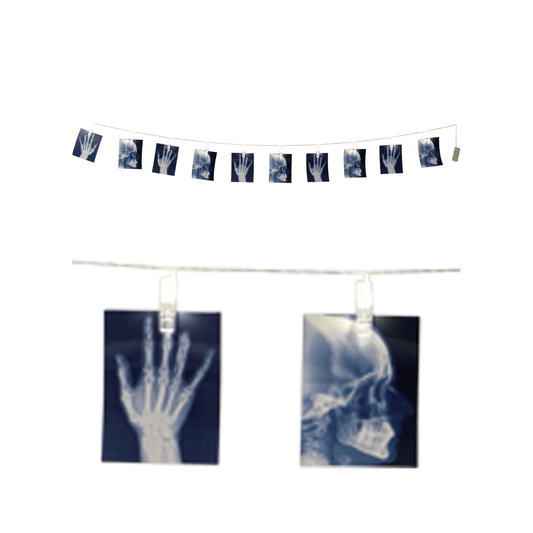 Alpha 55 Halloween, guirlande Radiographie 160 cm